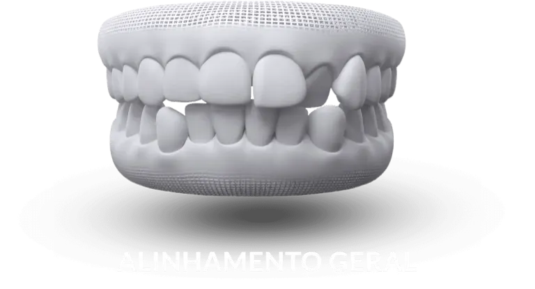 Ilustração de dentes desalinhados